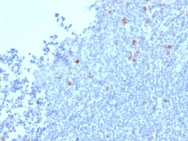 Immunohistochemistry (Formalin/PFA-fixed paraffin-embedded sections) - Anti-Granzyme B antibody [GZMB/2403] - BSA and Azide free (AB237847)