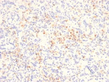 Immunohistochemistry (Formalin/PFA-fixed paraffin-embedded sections) - Anti-Granzyme B antibody [GZMB/2403] - BSA and Azide free (AB237847)