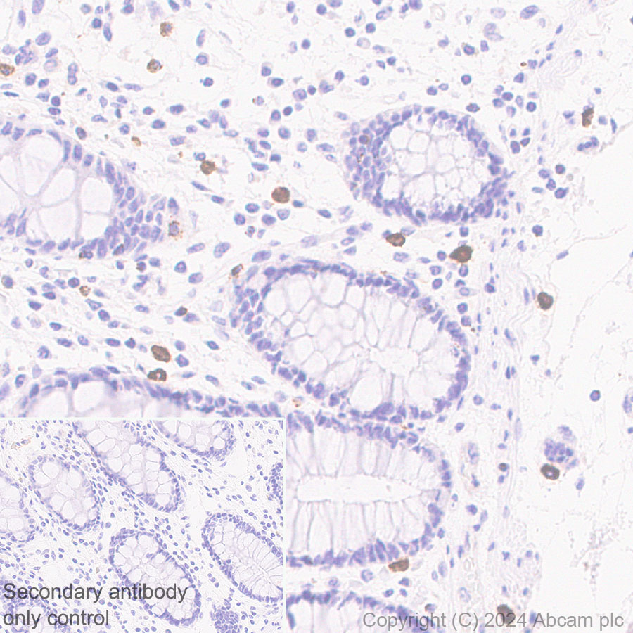 Immunohistochemistry (Formalin/PFA-fixed paraffin-embedded sections) - Anti-Granzyme B antibody [RM1165] - BSA and Azide free (ab317459), expandable thumbnail
