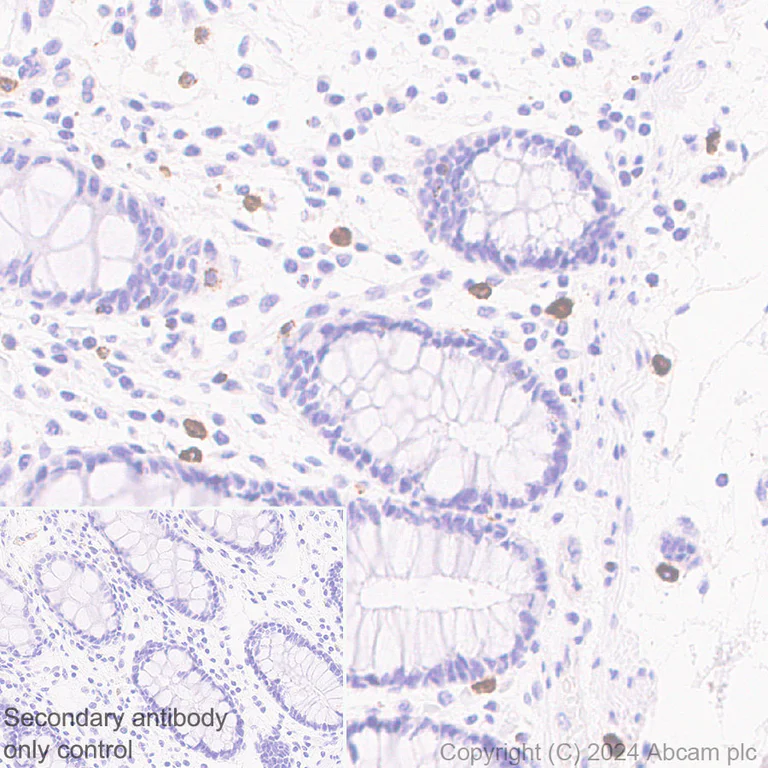 Immunohistochemistry (Formalin/PFA-fixed paraffin-embedded sections) - Anti-Granzyme B antibody [RM1165] - BSA and Azide free (AB317459)