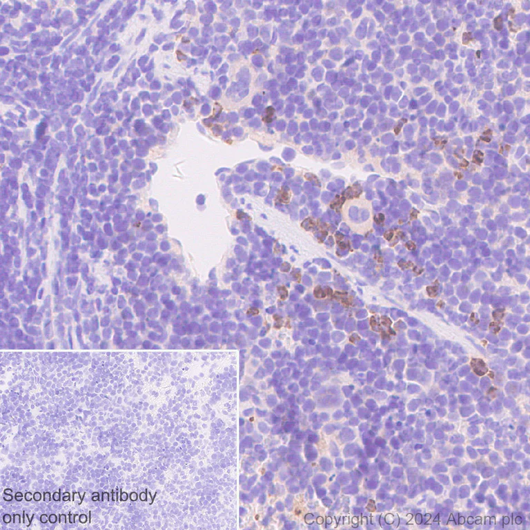 Immunohistochemistry (Formalin/PFA-fixed paraffin-embedded sections) - Anti-Granzyme B antibody [RM1165] - BSA and Azide free (AB317459)