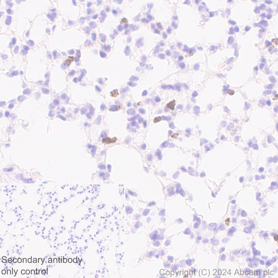 Immunohistochemistry (Formalin/PFA-fixed paraffin-embedded sections) - Anti-Granzyme B antibody [RM1165] - BSA and Azide free (ab317459), expandable thumbnail