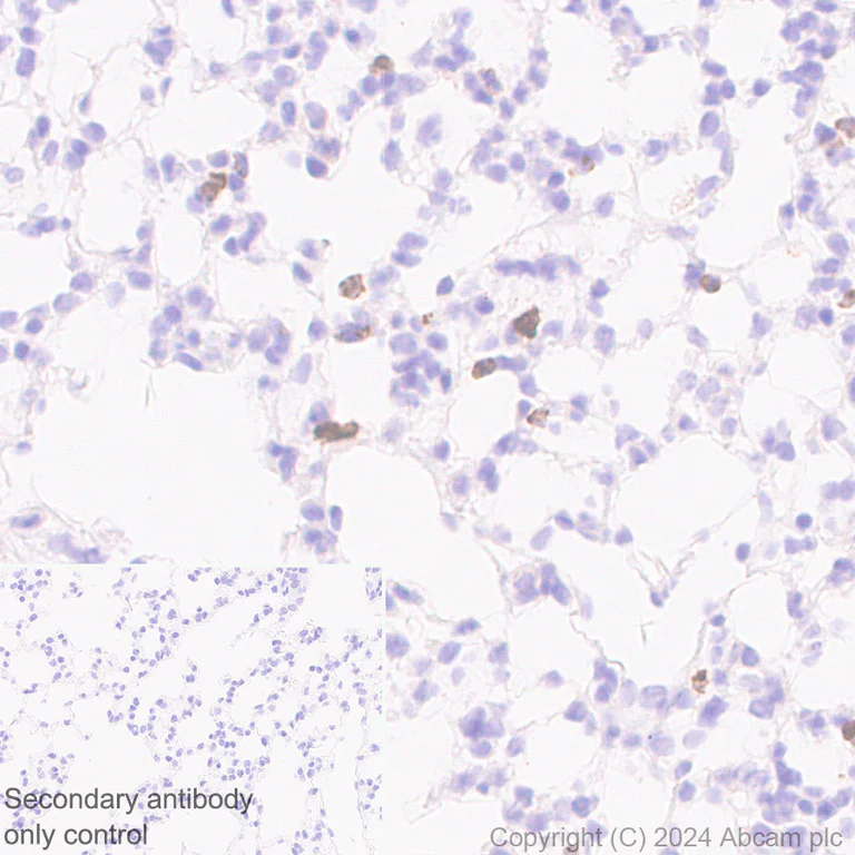 Immunohistochemistry (Formalin/PFA-fixed paraffin-embedded sections) - Anti-Granzyme B antibody [RM1165] - BSA and Azide free (AB317459)