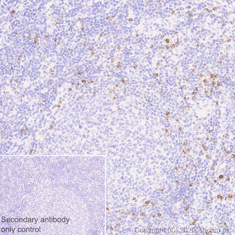 Immunohistochemistry (Formalin/PFA-fixed paraffin-embedded sections) - Anti-Granzyme K antibody [EPR24601-164] (AB282703)