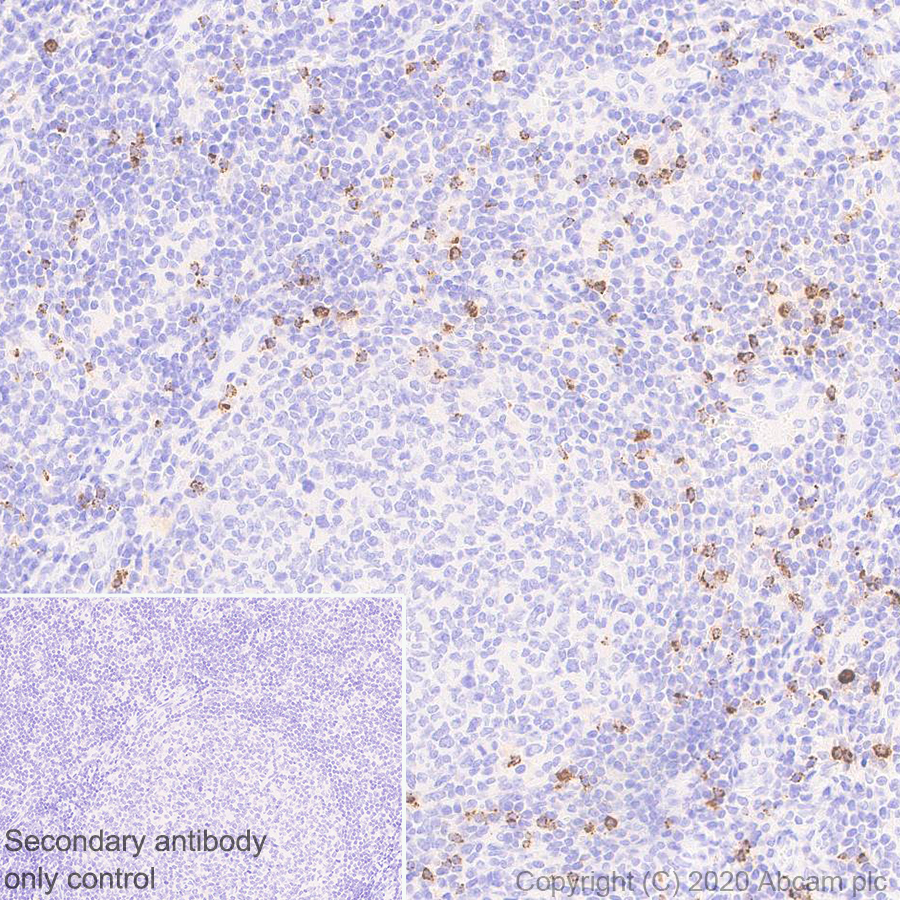 Immunohistochemistry (Formalin/PFA-fixed paraffin-embedded sections) - Anti-Granzyme K antibody [EPR24601-164] - BSA and Azide free (AB282714), expandable thumbnail