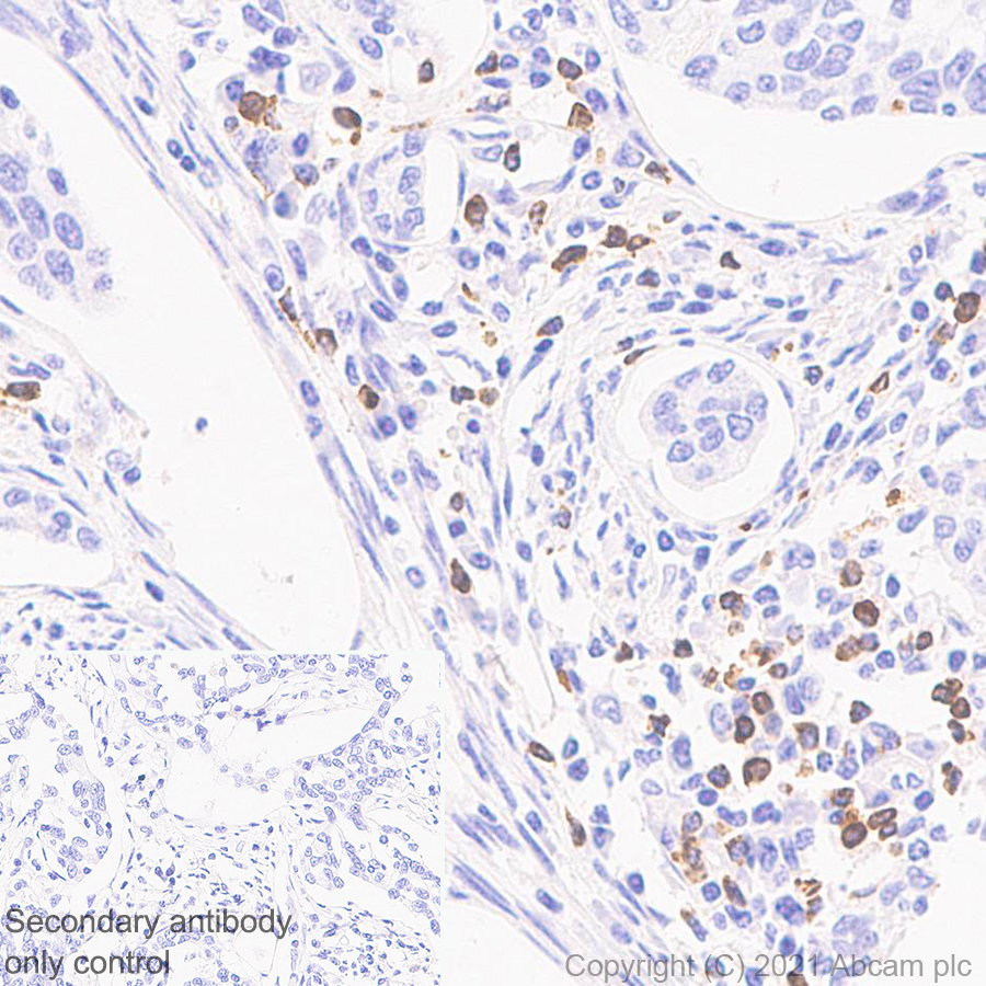 Immunohistochemistry (Formalin/PFA-fixed paraffin-embedded sections) - Anti-Granzyme K antibody [EPR24601-164] - BSA and Azide free (ab282714), expandable thumbnail