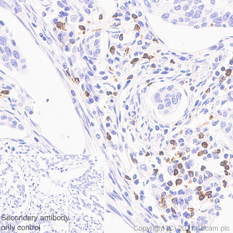 Immunohistochemistry (Formalin/PFA-fixed paraffin-embedded sections) - Anti-Granzyme K antibody [EPR24601-164] - BSA and Azide free (AB282714)