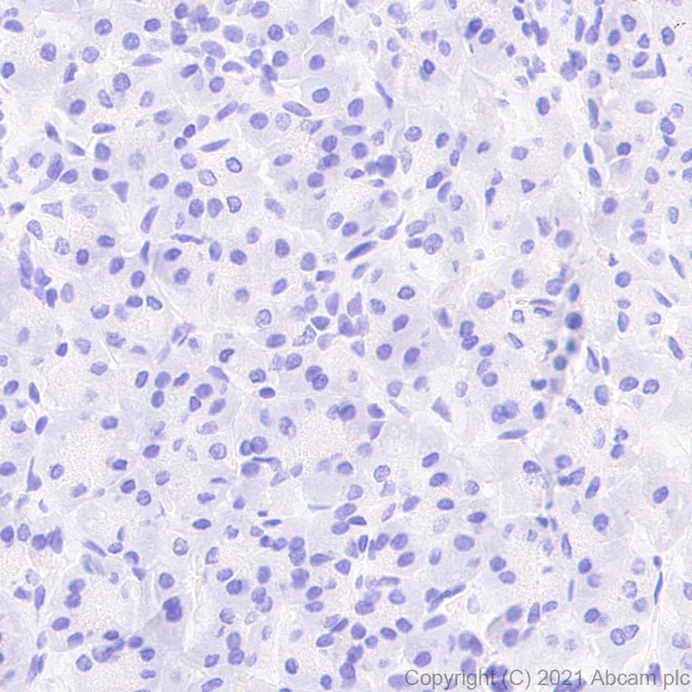 Immunohistochemistry (Formalin/PFA-fixed paraffin-embedded sections) - Anti-Granzyme K antibody [EPR24601-164] - BSA and Azide free (AB282714)