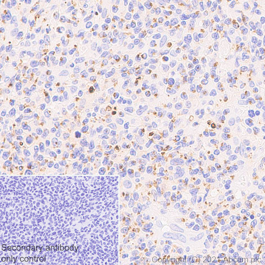 Immunohistochemistry (Formalin/PFA-fixed paraffin-embedded sections) - Anti-Granzyme K antibody [EPR24601-164] - BSA and Azide free (AB282714), expandable thumbnail