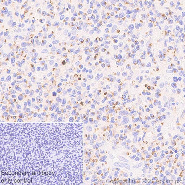 Immunohistochemistry (Formalin/PFA-fixed paraffin-embedded sections) - Anti-Granzyme K antibody [EPR24601-164] - BSA and Azide free (AB282714)