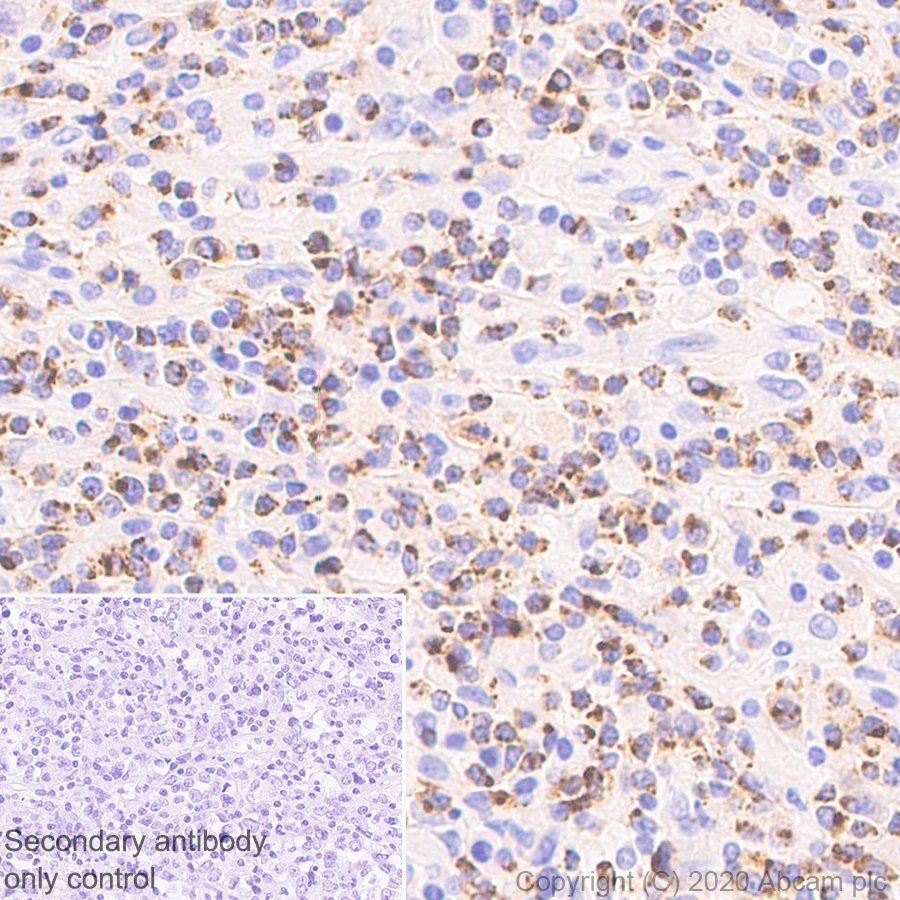 Immunohistochemistry (Formalin/PFA-fixed paraffin-embedded sections) - Anti-Granzyme K antibody [EPR24601-164] - BSA and Azide free (AB282714), expandable thumbnail