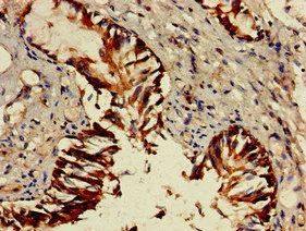 Immunohistochemistry (Formalin/PFA-fixed paraffin-embedded sections) - Anti-Granzyme M antibody (AB234746)
