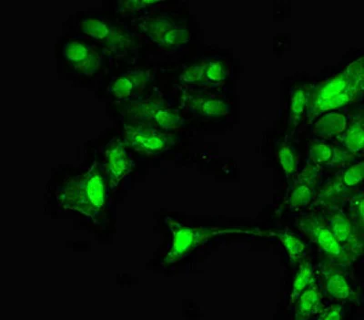 Immunocytochemistry/ Immunofluorescence - Anti-GRAP2 antibody (AB224613)