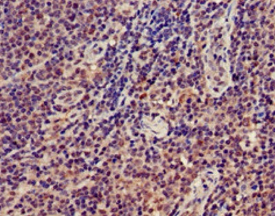 Immunohistochemistry (Formalin/PFA-fixed paraffin-embedded sections) - Anti-GRAP2 antibody (AB224613)