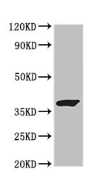 Western blot - Anti-GRAP2 antibody (AB224613)