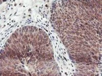 Immunohistochemistry (Formalin/PFA-fixed paraffin-embedded sections) - Anti-GRAP2 antibody [OTI1G2] (AB119244)