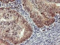 Immunohistochemistry (Formalin/PFA-fixed paraffin-embedded sections) - Anti-GRAP2 antibody [OTI1G2] (AB119244)