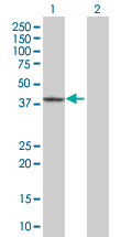 Western blot - GRAP2 overexpression 293T lysate (whole cell) (AB94236)
