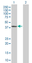 Western blot - GRAP2 overexpression 293T lysate (whole cell) (AB94236)