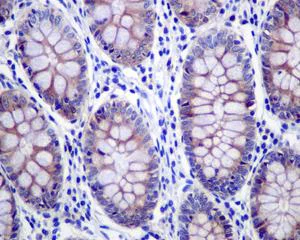 Immunohistochemistry (Formalin/PFA-fixed paraffin-embedded sections) - Anti-GRASP65 antibody [EPR12439] - C-terminal (AB174834)