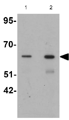 Western blot - Anti-GRB10 antibody (AB125583)