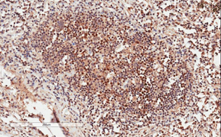 Immunohistochemistry (Formalin/PFA-fixed paraffin-embedded sections) - Anti-GRB2 antibody (AB2234)