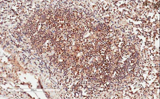 Immunohistochemistry (Formalin/PFA-fixed paraffin-embedded sections) - Anti-GRB2 antibody (AB2234)