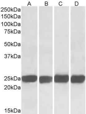 Western blot - Anti-GRB2 antibody (AB2234)