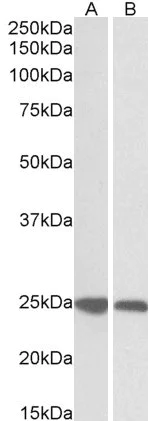 Western blot - Anti-GRB2 antibody (AB2234)
