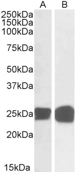 Western blot - Anti-GRB2 antibody (AB2234)