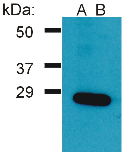 Western blot - Anti-GRB2 antibody (AB269341)