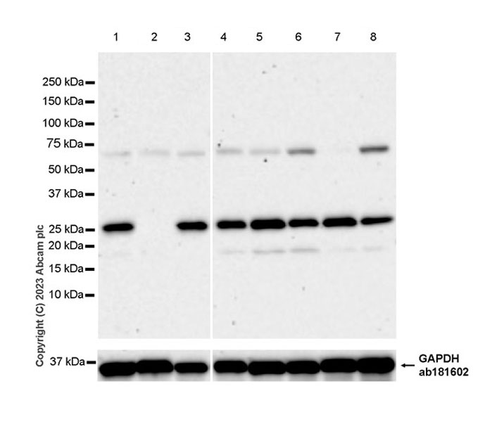 Western blot - Anti-GRB2 antibody [EPR24634-17] (AB315005), expandable thumbnail