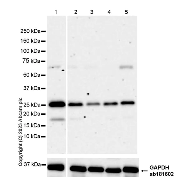 Western blot - Anti-GRB2 antibody [EPR24634-17] - BSA and Azide free (AB315006)