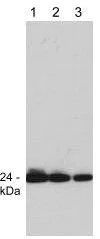 Western blot - Anti-GRB2 antibody [M331] (AB86713)