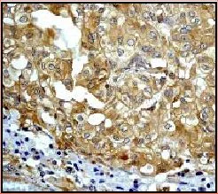 Immunohistochemistry (Formalin/PFA-fixed paraffin-embedded sections) - Anti-GRB2 antibody [Y237] (AB32037)
