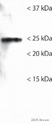 Western blot - Anti-GRB2 antibody [Y237] (AB32037)