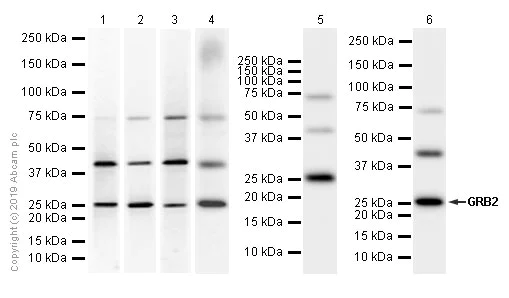 Western blot - Anti-GRB2 antibody [Y301] (AB32111)