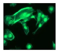 Immunocytochemistry/ Immunofluorescence - Anti-GRB2 antibody [Y301] - BSA and Azide free (AB247231)