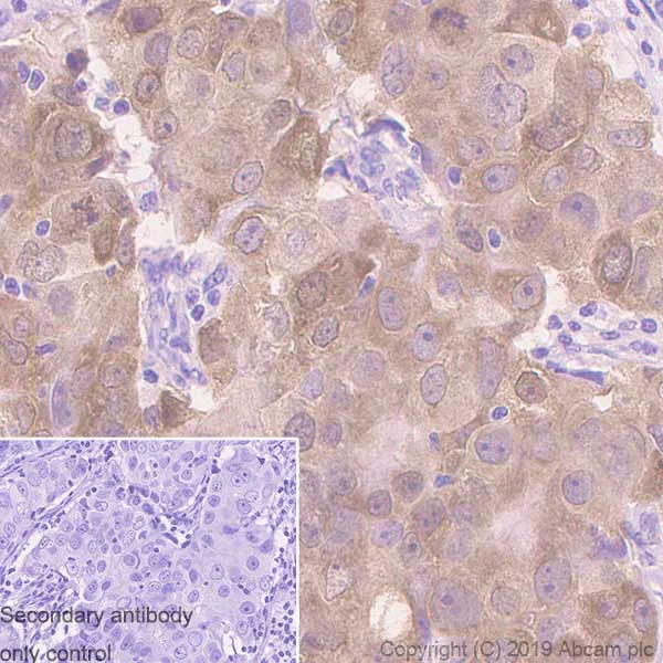 Immunohistochemistry (Formalin/PFA-fixed paraffin-embedded sections) - Anti-GRB7 antibody [EPR14099] - BSA and Azide free (AB250703)