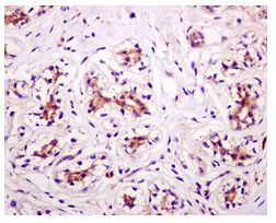 Immunohistochemistry (Formalin/PFA-fixed paraffin-embedded sections) - Anti-GRB7 antibody [EPR4378] (AB109618), expandable thumbnail