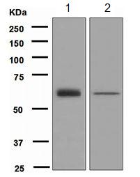 Western blot - Anti-GRB7 antibody [EPR4378] (AB109618), expandable thumbnail