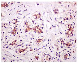 Immunohistochemistry (Formalin/PFA-fixed paraffin-embedded sections) - Anti-GRB7 antibody [EPR4378] - BSA and Azide free (AB247908)