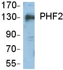 Western blot - Anti-GRC5 / PHF2 antibody (AB65771)