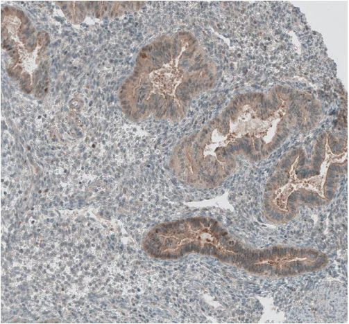 Immunohistochemistry (Formalin/PFA-fixed paraffin-embedded sections) - Anti-GREB1 antibody (AB270741)