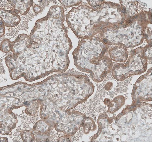 Immunohistochemistry (Formalin/PFA-fixed paraffin-embedded sections) - Anti-GREB1 antibody (AB270741)