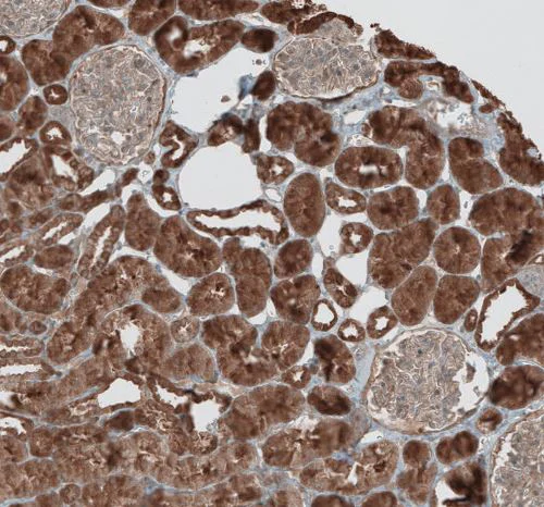 Immunohistochemistry (Formalin/PFA-fixed paraffin-embedded sections) - Anti-GREB1 antibody (AB270741)