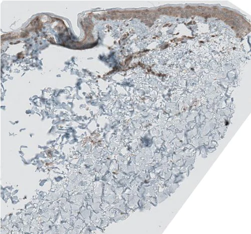 Immunohistochemistry (Formalin/PFA-fixed paraffin-embedded sections) - Anti-GREB1 antibody (AB270741)