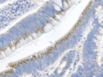 Immunohistochemistry (Formalin/PFA-fixed paraffin-embedded sections) - Anti-Gremlin 1 antibody (AB22138), expandable thumbnail