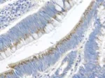 Immunohistochemistry (Formalin/PFA-fixed paraffin-embedded sections) - Anti-Gremlin 1 antibody (AB22138)