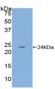 Western blot - Anti-Gremlin 1 antibody (AB231065)